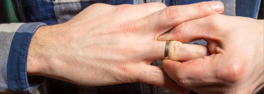 How to get a wedding ring off a swollen finger?